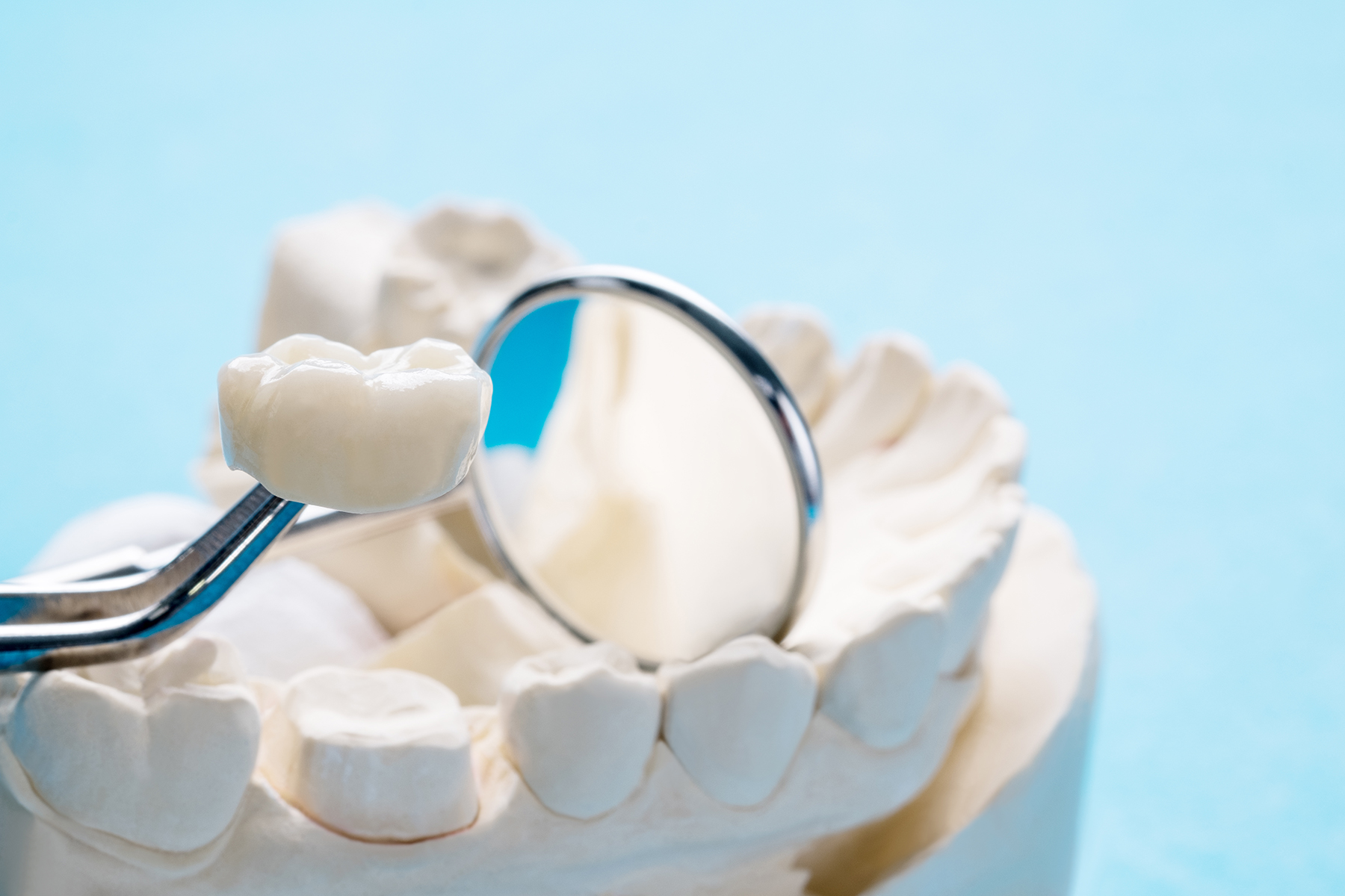 Dental crown treatment in Vero Beach, FL