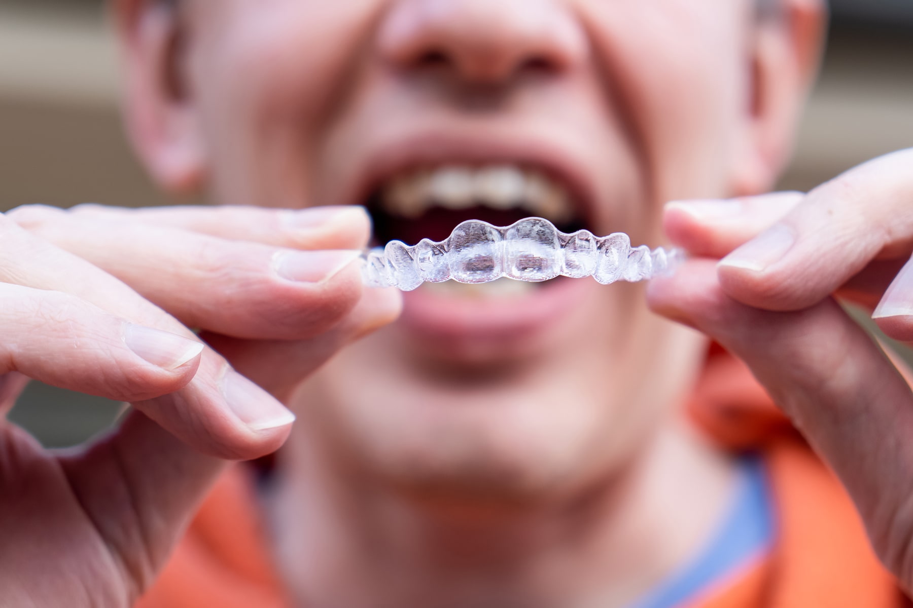 Man smiling after Invisalign consultation in Vero Beach, FL