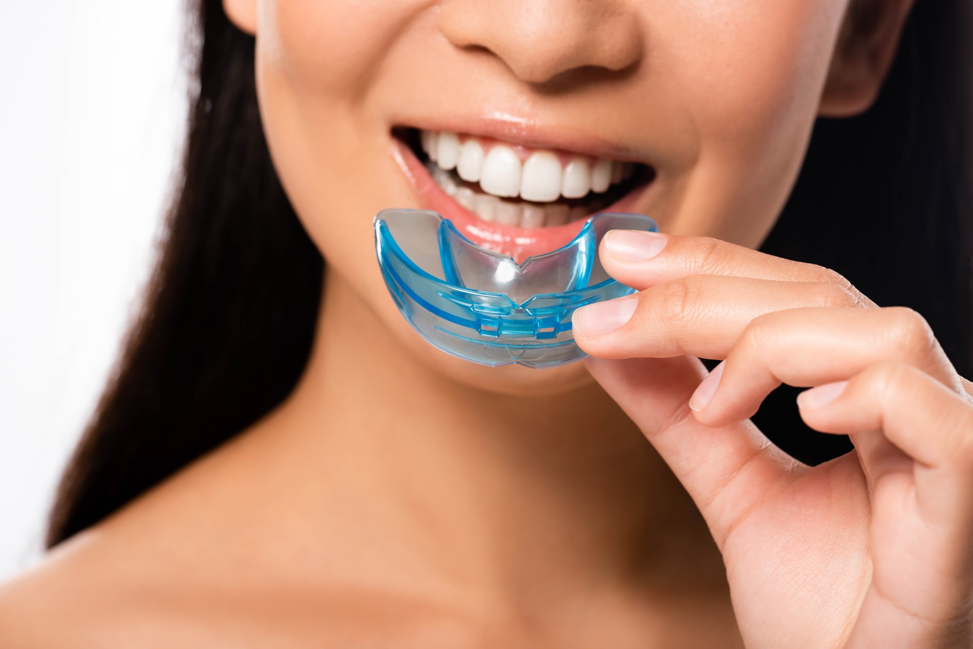 custom mouth guards from Novak Dental in Vero Beach FL